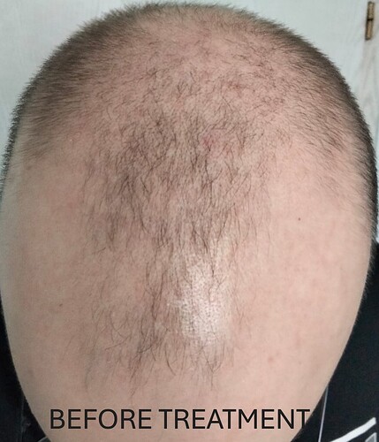 before_treatment (2)