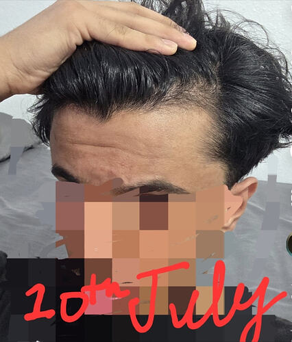 1000059152