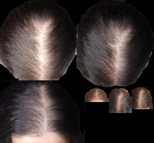 hair