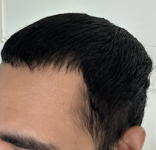before-right
