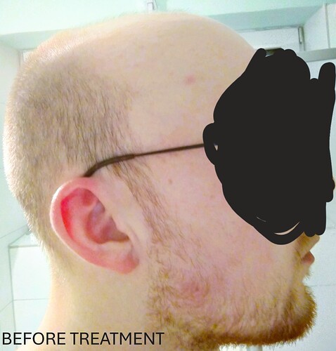 before_treatment