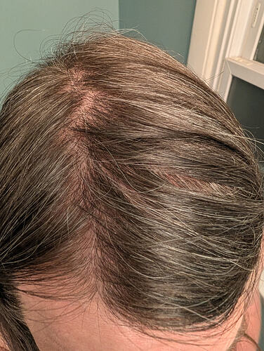 PXL_20260330_234309564