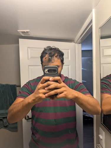 suggestions-to-reduce-hairloss-and-possible-growth-v0-uhitq4499s3h1