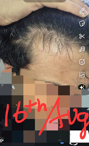 1000059171