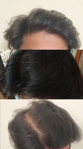 IMG_20260309_225801_631