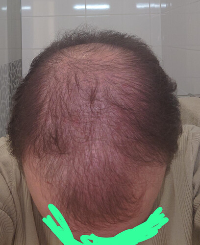 2510 haar.png