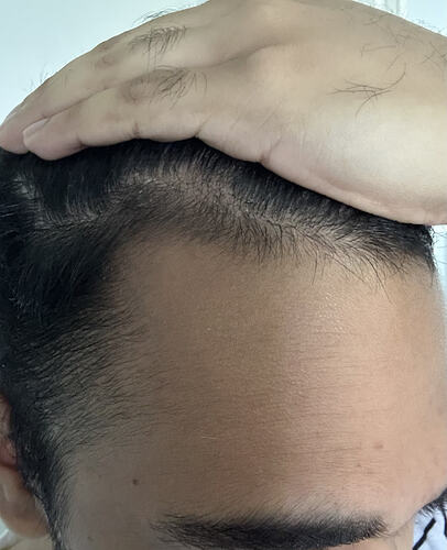 before-left-up