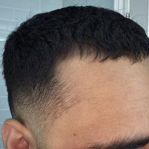 after-left