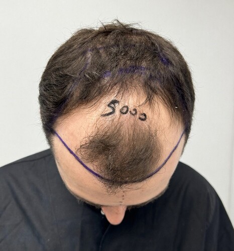 Before