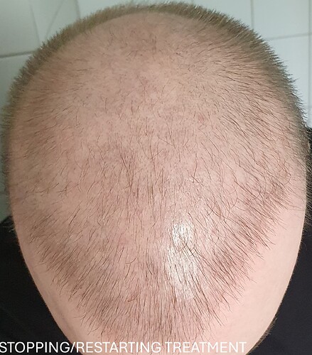 stopping_treatment (2)