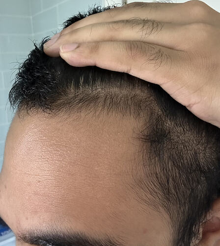 before-right-up