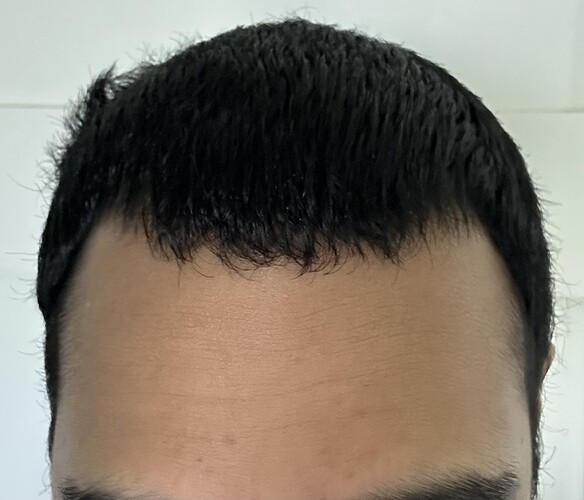 before-front