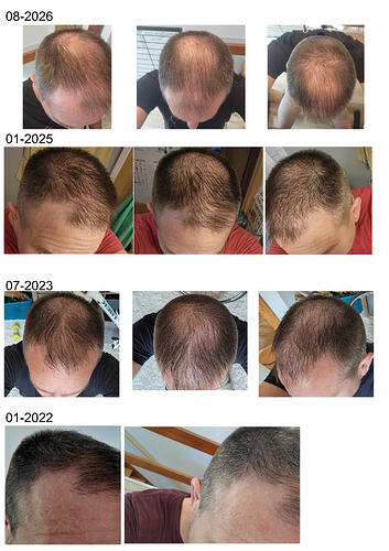 Hair History