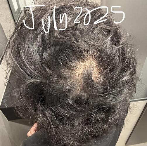 rich text editor image