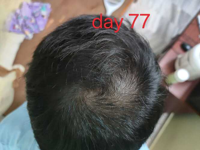 1000057356.jpg
