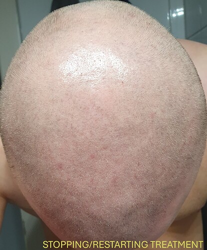 stopping_treatment (3)