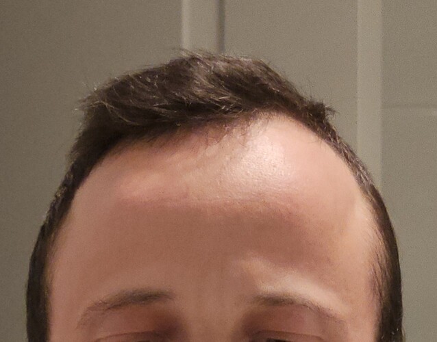 1000007737