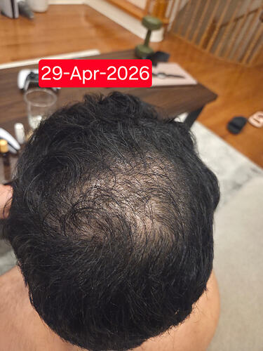 1000076272