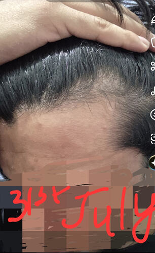 1000059158