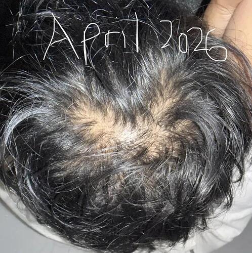 rich text editor image