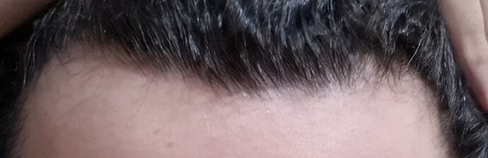 1000003514