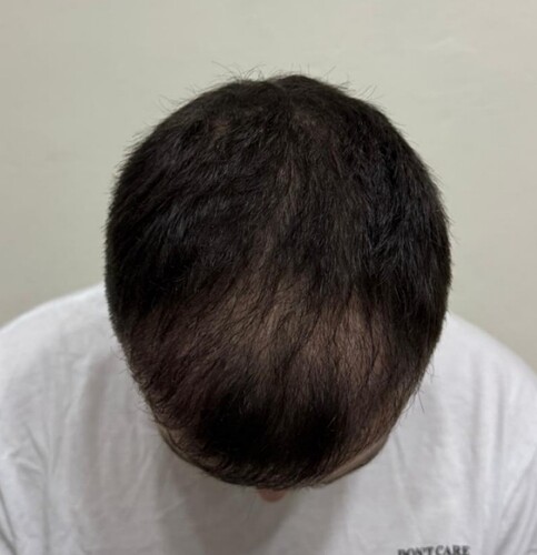 month 4