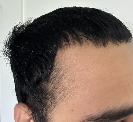 before-left