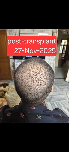 1000080576