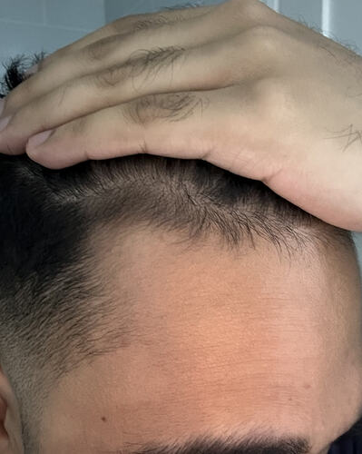 after-left-up