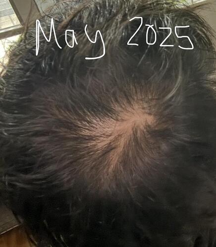 rich text editor image