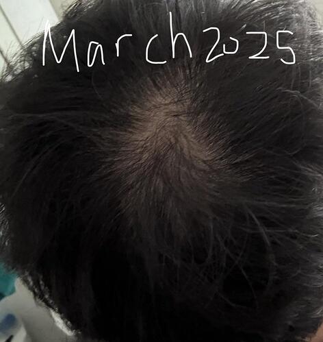 rich text editor image