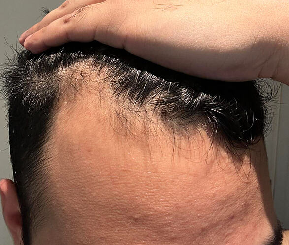 week-1-left
