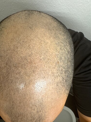 IMG_9830D479-AC57-4DE7-A7AA-1F1B186F7D24