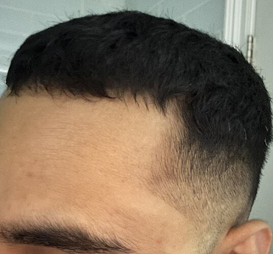 after-right