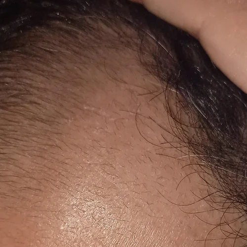 some-progress-here-1-month-progression-v0-p8jn4wzatb8f1